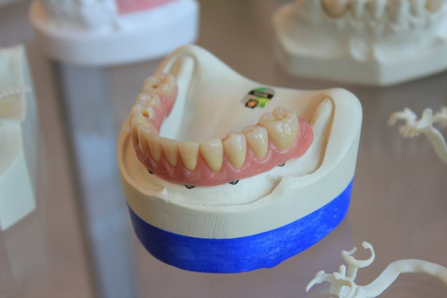 Prótesis dental sobre un modelo