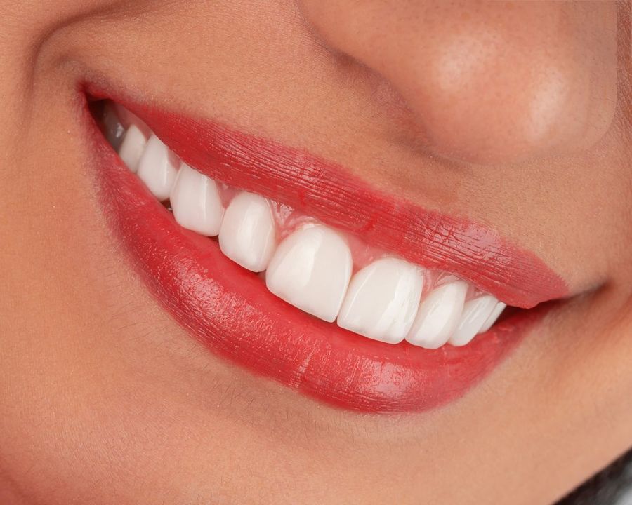 Sonrisa blanca y pareja